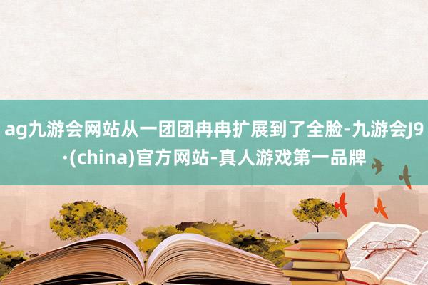 ag九游会网站从一团团冉冉扩展到了全脸-九游会J9·(china)官方网站-真人游戏第一品牌